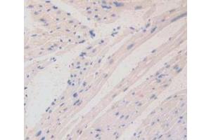 IHC-P analysis of Mouse Heart Tissue, with DAB staining. (LAMa4 抗体  (AA 745-940))