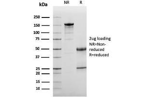 SDS-PAGE Analysis Purified Complement 3d Mouse Monoclonal Antibody (C3D/2891). (Complement 3d (C3d) (Acute Humoral Rejection Marker) 抗体)