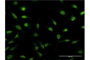Immunofluorescence of monoclonal antibody to PSMA1 on HeLa cell. (PSMA1 抗体  (AA 1-263))