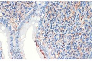 Immunohistochemistry of paraffin-embedded Human appendix using SST Polyclonal Antibody at dilution of 1:200 (40x lens). (Somatostatin 抗体)