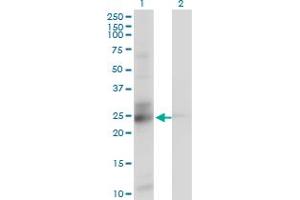 Western Blotting (WB) image for anti-Chromosome 21 Open Reading Frame 33 (C21orf33) (AA 188-268) antibody (ABIN563564)