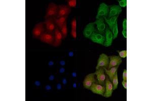 ABIN7093770 and ABIN7097811 staining Hela cells by IF/ICC. (p53 抗体)
