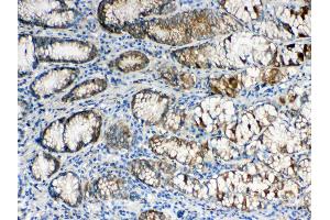 IHC analysis of ALDH1A3 using anti- ALDH1A3 antibody . (ALDH1A3 抗体  (AA 37-154))