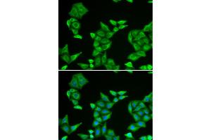 Immunofluorescence analysis of HeLa cell using COX5A antibody. (COX5A 抗体)