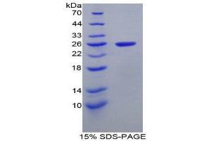 SDS-PAGE (SDS) image for Intercellular Adhesion Molecule 4 (ICAM4) (AA 32-226) protein (His tag) (ABIN2125364) (ICAM4 Protein (AA 32-226) (His tag))