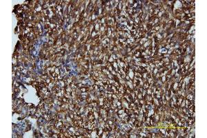 Immunostaining (ISt) image for anti-Low Density Lipoprotein Receptor Adaptor Protein 1 (LDLRAP1) (AA 1-263) antibody (ABIN565226)