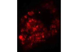 Immunofluorescence of PRICKLE1 in human bladder cells with PRICKLE1 antibody at 20 ug/mL. (PRICKLE1 抗体  (C-Term))