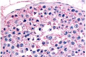 Immunohistochemistry (IHC) image for anti-Nuclear Receptor Subfamily 6, Group A, Member 1 (NR6A1) (Ligand Binding Domain) antibody (ABIN1049148)