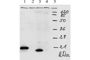 Western-Blot analysis of HPV-18 E7 protein. (HPV18 E7 抗体  (AA 1-35))