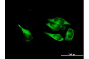Immunofluorescence (IF) image for anti-Methylenetetrahydrofolate Dehydrogenase (NADP+ Dependent) 1, Methenyltetrahydrofolate Cyclohydrolase, Formyltetrahydrofolate Synthetase (MTHFD1) (AA 1-935) antibody (ABIN518072)