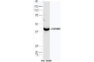 Mouse brain lysates probed with Rabbit Anti-CADM3 Polyclonal Antibody, Unconjugated  at 1:5000 for 90 min at 37˚C. (CADM3 抗体  (AA 101-200))
