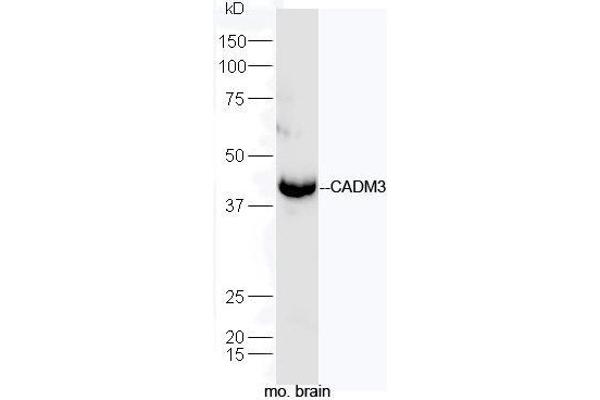 CADM3 抗体  (AA 101-200)