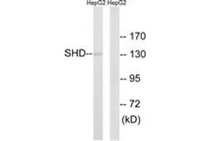 Western blot analysis of extracts from HepG2 cells, using SHD Antibody. (SHD 抗体  (AA 141-190))