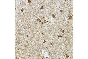 Immunohistochemistry of paraffin-embedded human brain using EP/HIF2α Rabbit pAb (ABIN6127869, ABIN6141764, ABIN6141765 and ABIN6223457) at dilution of 1:100 (40x lens). (EPAS1 抗体  (AA 588-870))