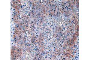 IHC-P analysis of adrenal gland tissue, with DAB staining. (CPT1A 抗体  (AA 572-773))