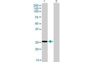 Western Blot analysis of RNF141 expression in transfected 293T cell line by RNF141 monoclonal antibody (M01), clone 6D9. (RNF141 抗体  (AA 141-229))