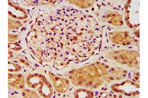 IHC image of ABIN7176620 diluted at 1:200 and staining in paraffin-embedded human kidney tissue performed on a Leica BondTM system.