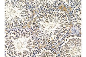 ABIN7095605 and ABIN7099667 at 1/100 staining rat testis tissue by IHC-P. (HSC70 Interacting Protein HIP 抗体)