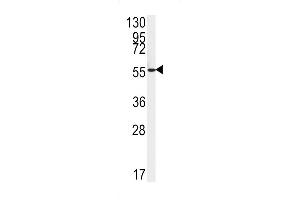 Western blot analysis of FAAH2 Antibody in HepG2 cell line lysates (35ug/lane) (FAAH2 抗体  (C-Term))