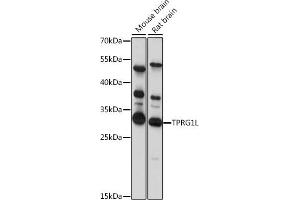 Western blot analysis of extracts of various cell lines, using TPRG1L antibody (ABIN7271100) at 1:1000 dilution. (TPRG1L 抗体  (AA 1-90))