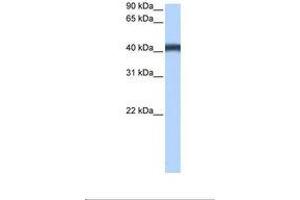 Image no. 1 for anti-Major Facilitator Superfamily Domain Containing 3 (MFSD3) (AA 321-370) antibody (ABIN6739342) (MFSD3 抗体  (AA 321-370))
