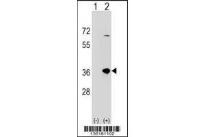 Western blot analysis of SULT1B1 using rabbit polyclonal SULT1B1 Antibody using 293 cell lysates (2 ug/lane) either nontransfected (Lane 1) or transiently transfected (Lane 2) with the SULT1B1 gene. (SULT1B1 抗体  (C-Term))