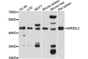 Western Blotting (WB) image for anti-Killer Cell Immunoglobulin-Like Receptor, three Domains, Long Cytoplasmic Tail, 2 (KIR3DL2) antibody (ABIN4904158)