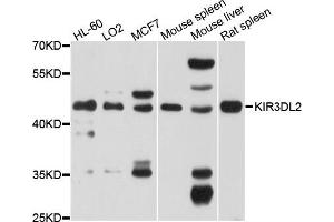 Western blot analysis of extracts of various cells, using KIR3DL2 antibody. (KIR3DL2 抗体)