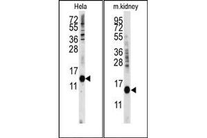 Image no. 1 for anti-Cytidine Deaminase (CDA) (C-Term) antibody (ABIN358052) (CDA 抗体  (C-Term))