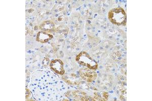 Immunohistochemistry of paraffin-embedded rat kidney using RNASEL antibody. (RNASEL 抗体)