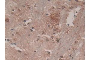 DAB staining on IHC-P; Samples: Rat Brain Tissue (CSF1R 抗体  (AA 734-900))