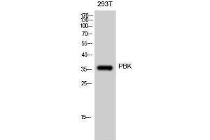 Western Blotting (WB) image for anti-PDZ Binding Kinase (PBK) (Tyr685), (Tyr753) antibody (ABIN3186349) (PBK 抗体  (Tyr685, Tyr753))