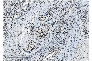 IHC analysis of NRF1 using anti-NRF1 antibody (ABIN7600874).