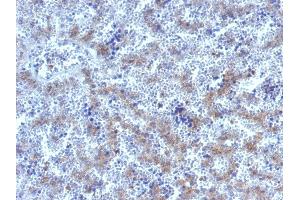 Formalin-fixed, paraffin-embedded human Fetal Liver stained with Glypican-3 Rabbit Polyclonal Antibody. (Glypican 3 抗体)