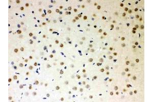 Anti-PKC iota Picoband antibody, (ABIN3043909),IHC(P)IHC(P): Rat Brain Tissue (PKC iota 抗体  (AA 21-214))