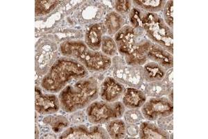 Immunohistochemical staining of human kidney with GRAMD2 polyclonal antibody  shows strong cytoplasmic and membranous positivity in tubular cells. (GRAMD2 抗体)