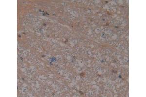 IHC-P analysis of Rat Tissue, with DAB staining. (THBS4 抗体  (AA 708-963))