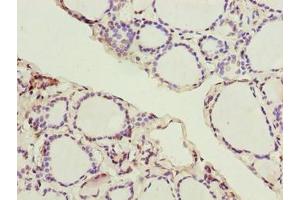Immunohistochemistry of paraffin-embedded human thyroid tissue using ABIN7170271 at dilution of 1:100 (GPR172B 抗体  (AA 212-279))