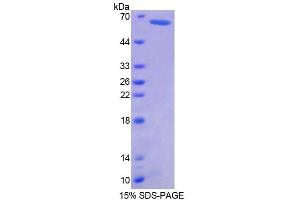SDS-PAGE analysis of Human GMNN Protein. (Geminin 蛋白)