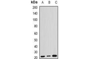 Western blot analysis of ARL6 expression in HEK293T (A), mouse kidney (B), mouse brain (C) whole cell lysates. (ARL6 抗体)