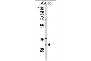 Western blot analysis of ING5 Antibody in A2058 cell line lysates (35ug/lane) (ING5 抗体  (AA 91-119))