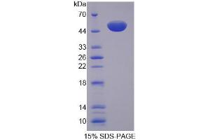 SDS-PAGE analysis of Rat MTIF2 Protein. (MTIF2 蛋白)