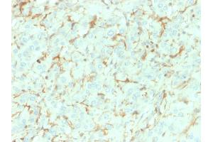 Formalin-fixed, paraffin-embedded human Adrenal Gland stained with NGFR Mouse Monoclonal Antibody (NGFR/1964). (NGFR 抗体  (AA 281-421))
