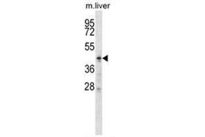 ZDHHC6 Antibody (C-term) western blot analysis in mouse liver tissue lysates (35 µg/lane). (ZDHHC6 抗体  (C-Term))