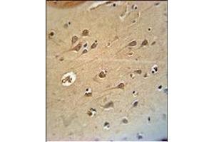 RAT DLG4 Antibody (C-term)(Ascites) ABIN658997 immunohistochemistry analysis in formalin fixed and paraffin embedded human brain tissue followed by peroxidase conjμgation of the secondary antibody and DAB staining. (DLG4 抗体  (C-Term))