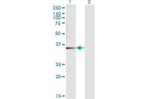 Western Blot analysis of SNX11 expression in transfected 293T cell line by SNX11 monoclonal antibody (M05), clone 2G1. (SNX11 抗体  (AA 1-270))
