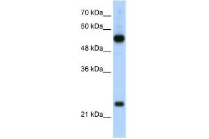 WB Suggested Anti-RPL13 Antibody Titration:  2. (RPL13 抗体  (C-Term))