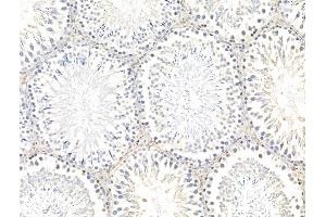 ABIN7094753 and ABIN7098804 at 1/100 staining Rat testis tissue by IHC-P.