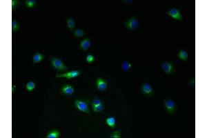 Immunofluorescent analysis of A2780 cells using ABIN7173225 at dilution of 1:100 and Alexa Fluor 488-congugated AffiniPure Goat Anti-Rabbit IgG(H+L) (TMEM45A 抗体  (AA 171-217))