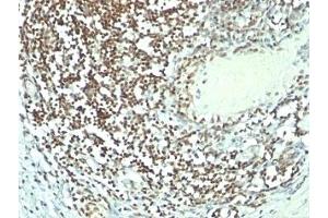 Immunohistochemistry (Formalin-fixed Paraffin-embedded Sections) (IHC (fp)) image for anti-Nucleolin (NCL) antibody (ABIN3025717)